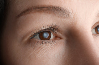 Peut-on corriger sa vision en même temps qu’une chirurgie de la cataracte ?