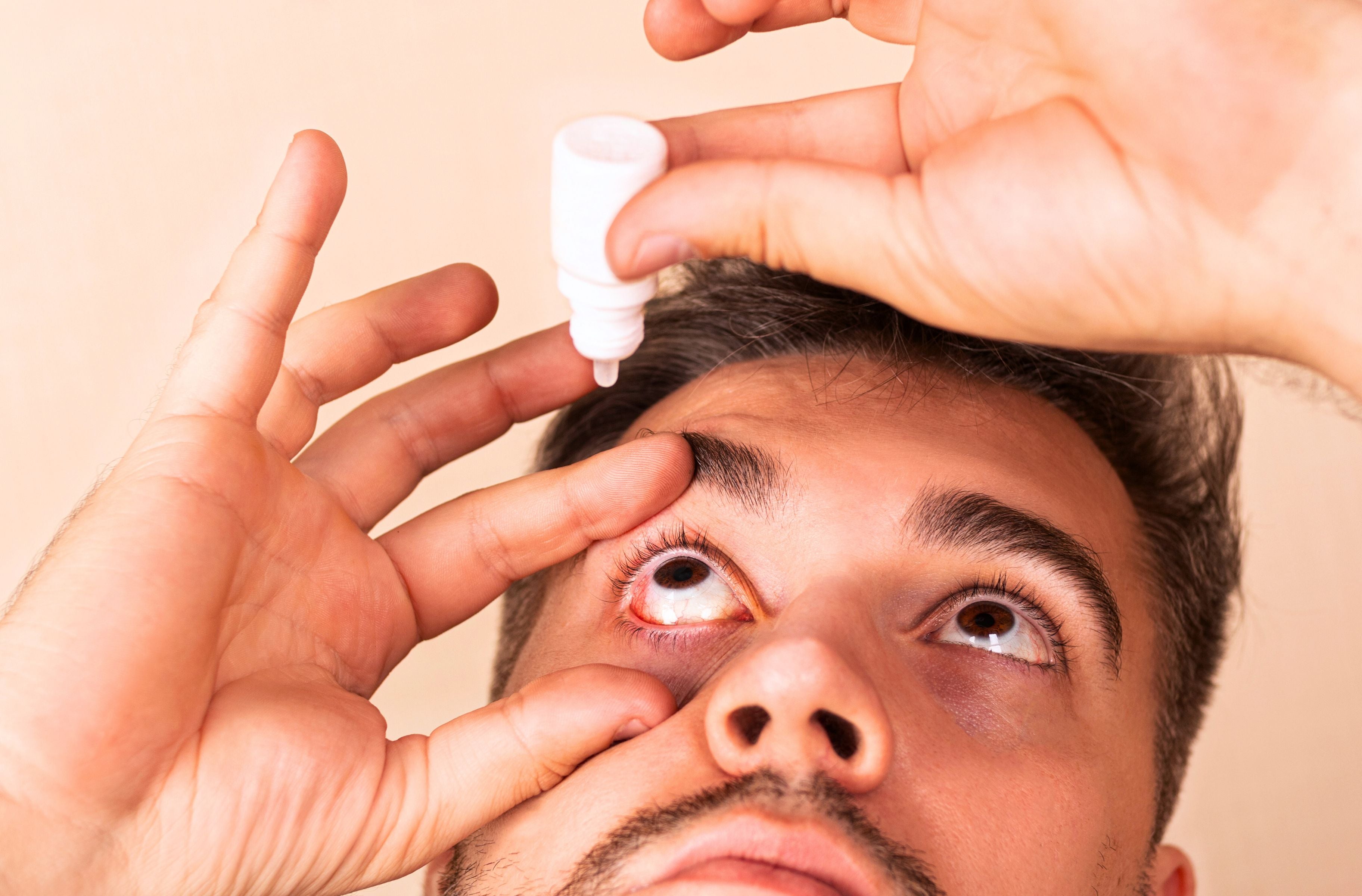 Contour des yeux rouges et yeux secs: Identifier les causes et trouver ...