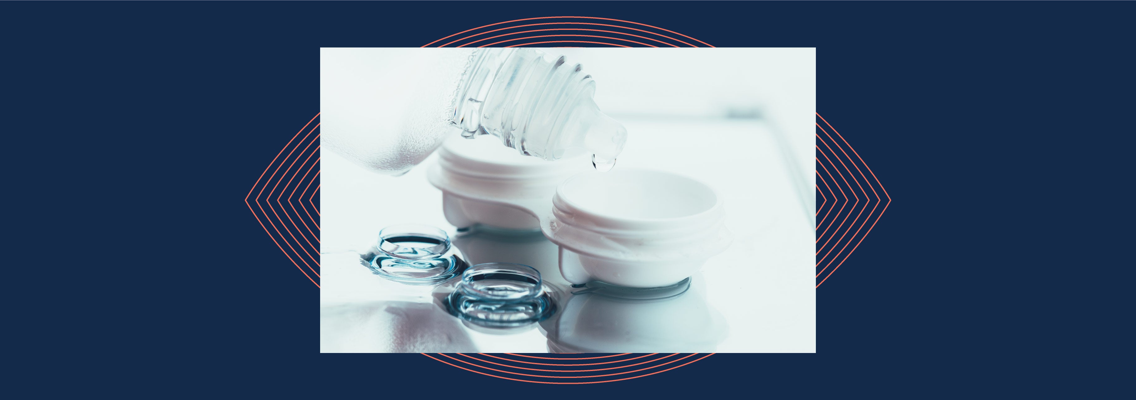 Photo of a contact lens case next to two contact lenses on a countertop, while contact lens solution is being poured in the case.